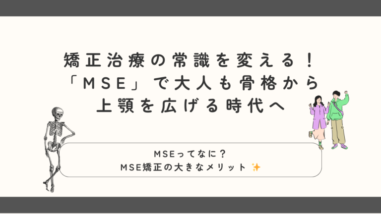 MSE